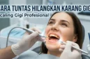 Ilustrasi Pembersihan Karang Gigi.