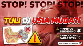 Ilustrasi - Kebiasaan Pakai Earphone Berlebih Bisa Ancam Pendengaran Anda
